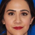 How Long After Fillers Do You See Results?