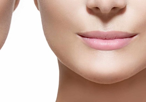 How Often Should You Get Juvederm Fillers? A Guide to Long-Lasting Results
