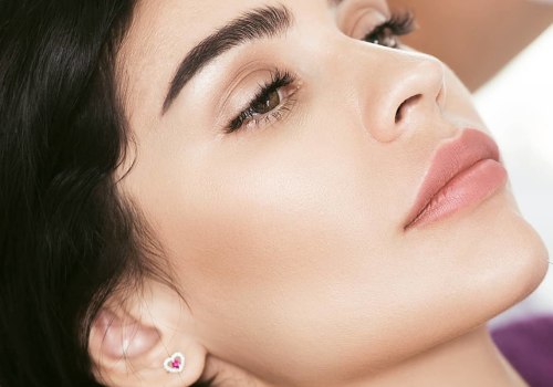 How Long After Filler Can You Get It Dissolved?