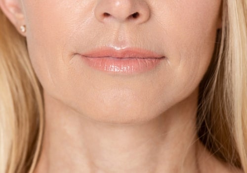 Can Fillers Get Rid of Jowls?