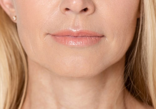 Can fillers get rid of jowls?