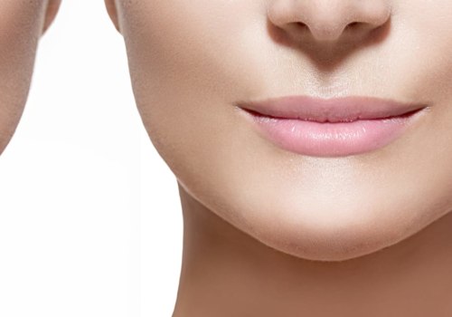 Is juvederm lip filler safe?