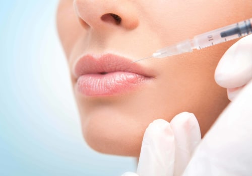 Can Juvederm Be Reversed? Expert Advice on Undoing Filler Results