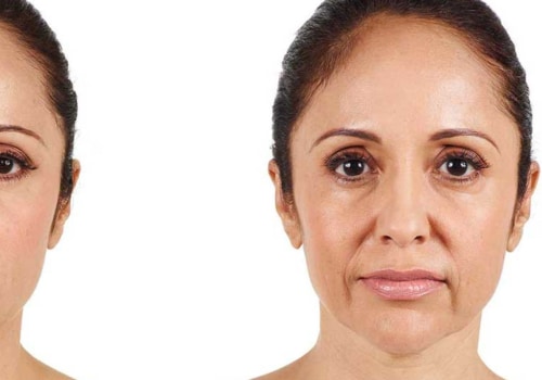 Juvederm: The Best Dermal Filler for Facial Rejuvenation