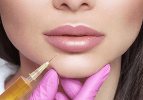 Which Juvederm Gives the Most Volume?