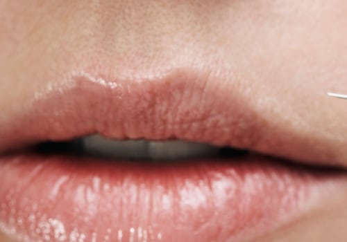 Can Juvederm Cause Blindness? - A Comprehensive Guide